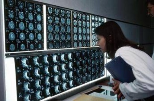 Cancro, 4 sintomi 'insoliti' che bisogna conoscere: parola di oncologo