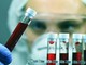 Alzheimer, Sin: &quot;Test del sangue svolta epocale per diagnosi tempestive e cure mirate&quot;