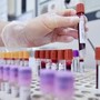 Dal microbiota una speranza contro l'epilessia resistente, lo studio italiano