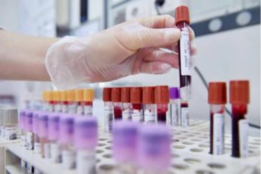 Cancro al seno, oncologi: &quot;Bene test genomici nei nuovi Lea, fare presto&quot;
