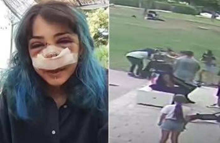 Picchiata al Parco Rossani, processo al via il 4 novembre: la 26enne ha pubblicato il video dell’aggressione Picchiata al Parco Rossani, processo al via il 4 novembre: la 26enne ha pubblicato il video dell’aggressione
