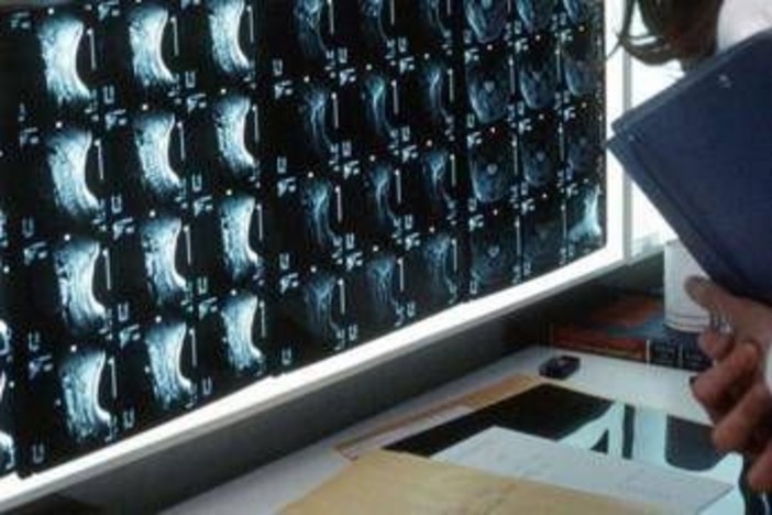 Oltre 500 malattie rare delle ossa, esperti: &quot;Investire in prevenzione e diagnosi&quot;