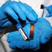 Hantavirus, test negativo per la persona in isolamento in Veneto Hantavirus, test negativo per la persona in isolamento in Veneto