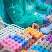 Colesterolo, dagli occhi ai piedi tre spie del livello d'allarme