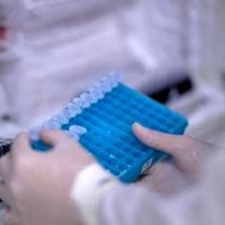 Scoperto il virus gigante Ushikuvirus, lo studio: "Può darci indizi su origine della vita"