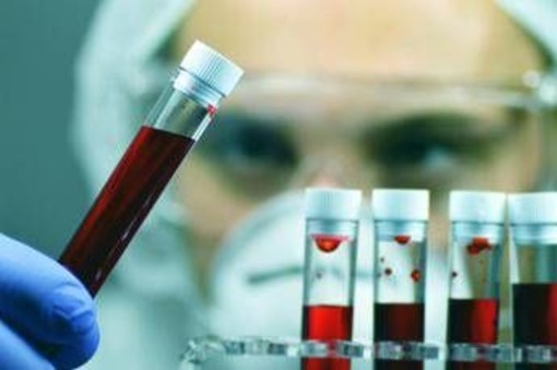 Alzheimer, Sin: &quot;Test del sangue svolta epocale per diagnosi tempestive e cure mirate&quot;
