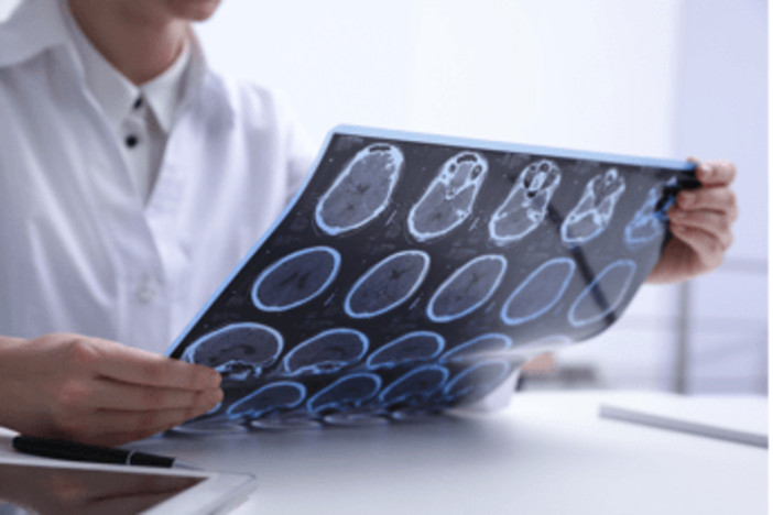 Sclerosi multipla, neurologi: &quot;Con nuovi strumenti la diagnosi sempre più precoce&quot;