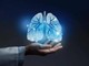 Cancro polmone, ok Ue a tislelizumab in neoadiuvante e adiuvante