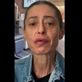 Gerardina Trovato annulla il tour: "Devo operarmi d'urgenza" Gerardina Trovato annulla il tour: "Devo operarmi d'urgenza"