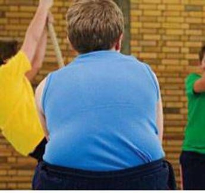 Obesità grave pediatri Sip: &quot;Per oltre 100mila bimbi rischio -15 anni vita&quot;
