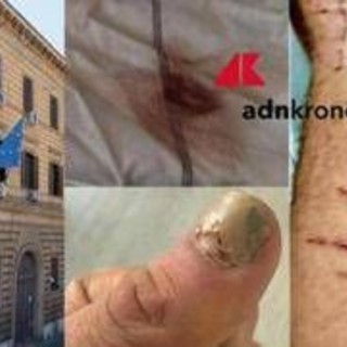 Denunciò botte e sequestro in cella: "Ora vivo nella paura, colpisce il silenzio delle istituzioni" Denunciò botte e sequestro in cella: "Ora vivo nella paura, colpisce il silenzio delle istituzioni"