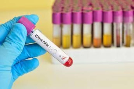 Infezione da West Nile: cos'è la malattia, sintomi e raccomandazioni